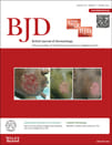 British Journal of Dermatology